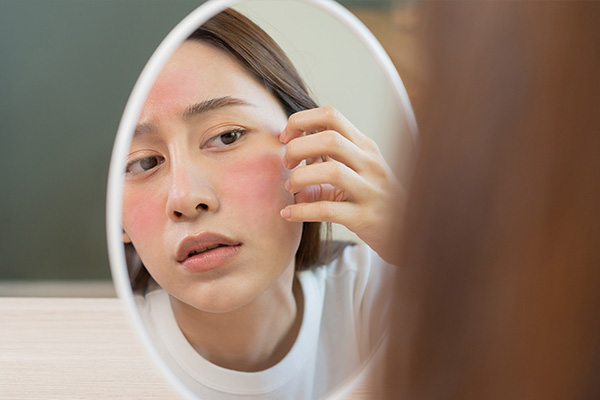 Productos naturales para el cuidado de la piel podrían ocasionar alergias
